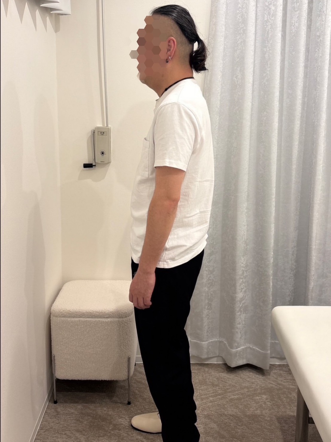 BEFORE - 数回の施術で肩こりが激減