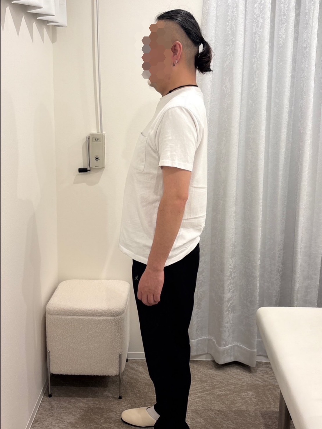 AFTER - 数回の施術で肩こりが激減